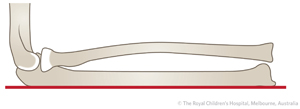 ED_Section 6_Box_shaft_ulna border_normal.jpg